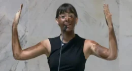 Deputada Fabiana Bolsonaro faz 'blackface' em protesto transfóbico