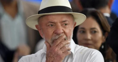 Lula faz radioterapia após retirar lesão de câncer de pele no couro cabeludo
